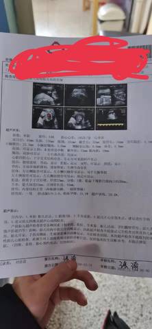 journal_insert_pic_1685513059