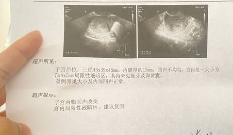 journal_insert_pic_1689472426