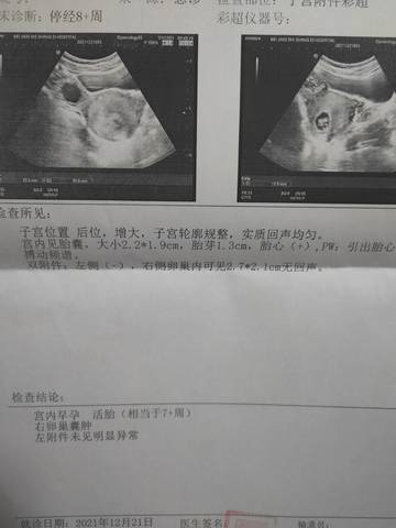 journal_insert_pic_1684868463