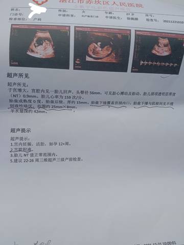 journal_insert_pic_1685942743