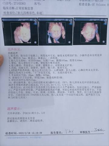 journal_insert_pic_1719633115