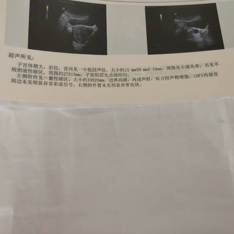 journal_insert_pic_1687840486