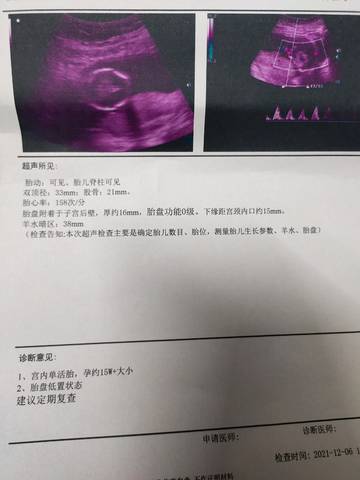 journal_insert_pic_1675053626