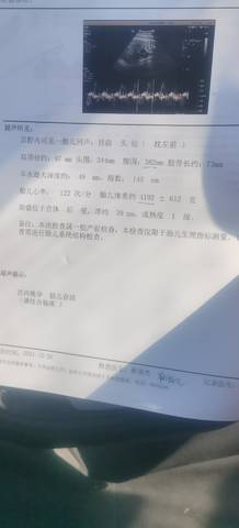 journal_insert_pic_1687440698