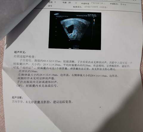 journal_insert_pic_1686025124