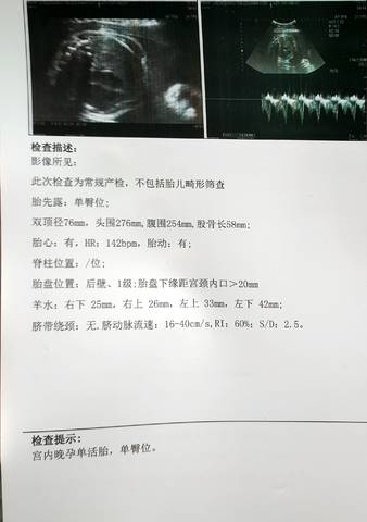 journal_insert_pic_1675337194
