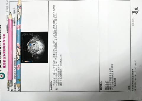 journal_insert_pic_1684371217