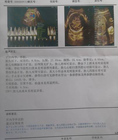 journal_insert_pic_1685792018