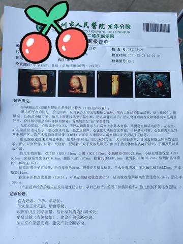 journal_insert_pic_1674875224