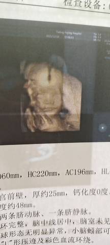 journal_insert_pic_1677341255