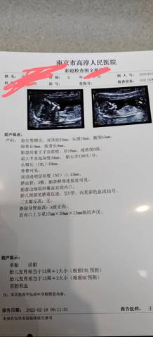 journal_insert_pic_1719508694