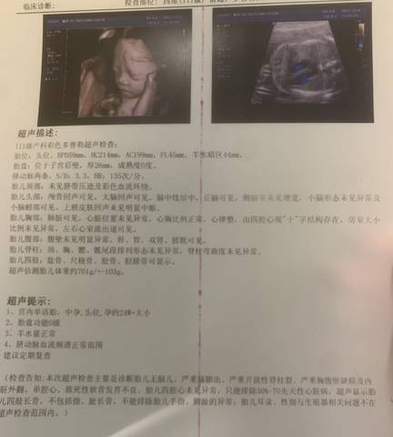 journal_insert_pic_1674867473