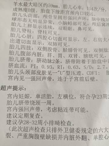 journal_insert_pic_1684571256