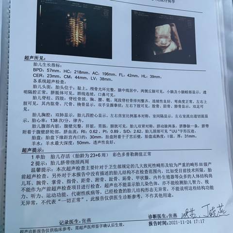 journal_insert_pic_1678949333