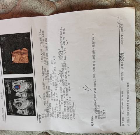 journal_insert_pic_1673948669
