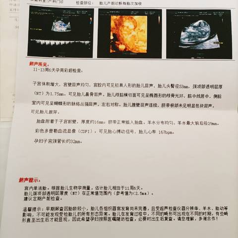 journal_insert_pic_1688352612