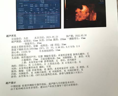 journal_insert_pic_1677416591