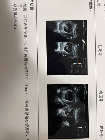 journal_insert_pic_1683799912