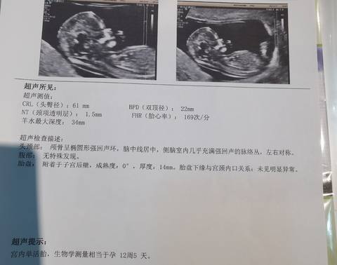journal_insert_pic_1689745887