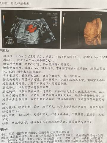 journal_insert_pic_1678015952