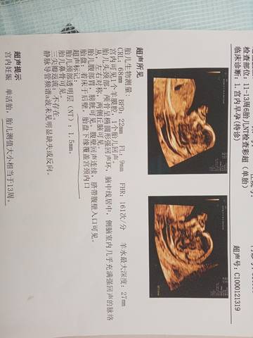 journal_insert_pic_1675422110