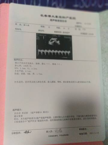 journal_insert_pic_1682140339