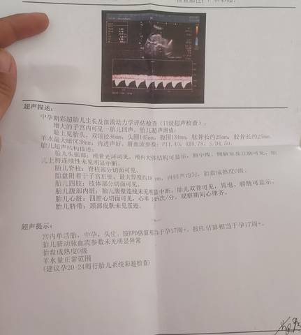 journal_insert_pic_1675810797