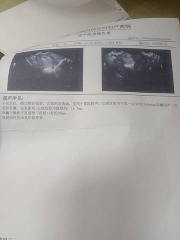 journal_insert_pic_1683198676