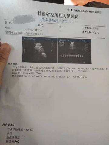 journal_insert_pic_1682614974