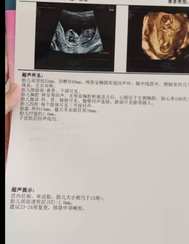 journal_insert_pic_1678632416