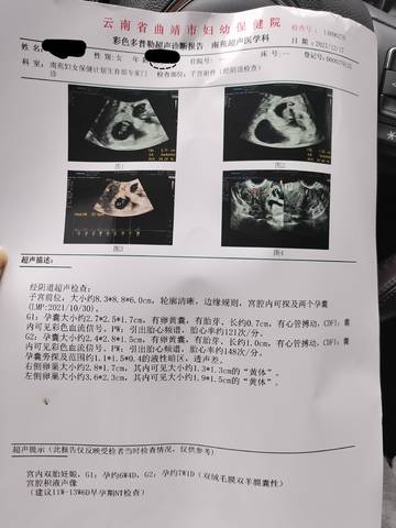 journal_insert_pic_1682113861