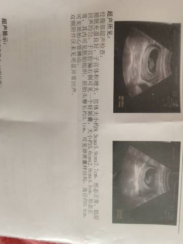 journal_insert_pic_1675997795