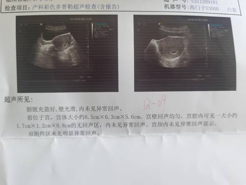 journal_insert_pic_1677534445