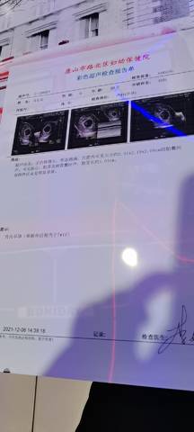 journal_insert_pic_1690257321