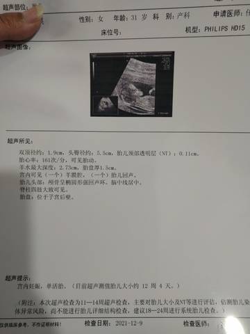 journal_insert_pic_1676930198