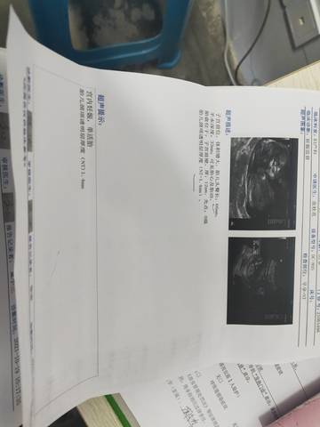 journal_insert_pic_1685851477