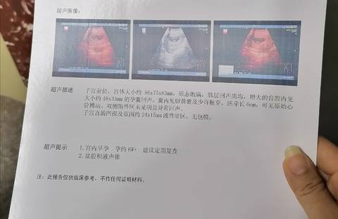 journal_insert_pic_1685762735