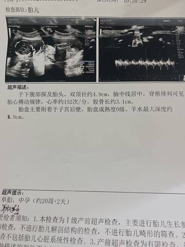 journal_insert_pic_1682812247