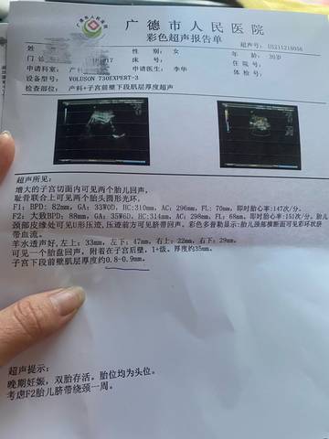 journal_insert_pic_1682207239