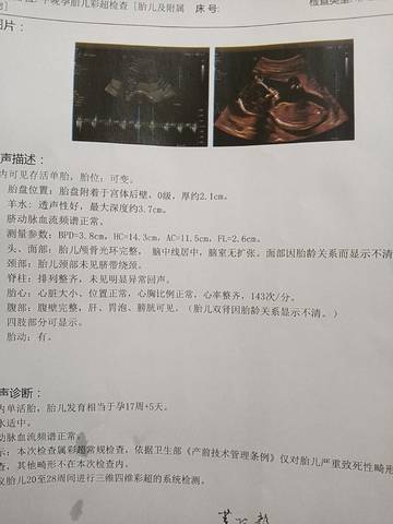 journal_insert_pic_1676900815