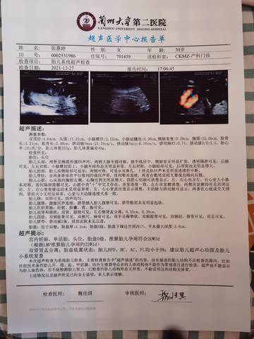 journal_insert_pic_1689699464