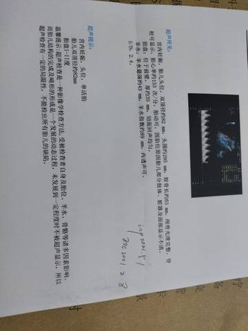 journal_insert_pic_1683737475