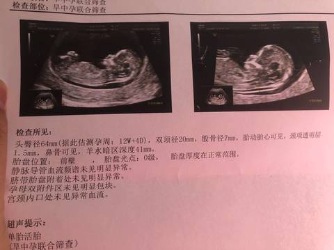 journal_insert_pic_1674113350