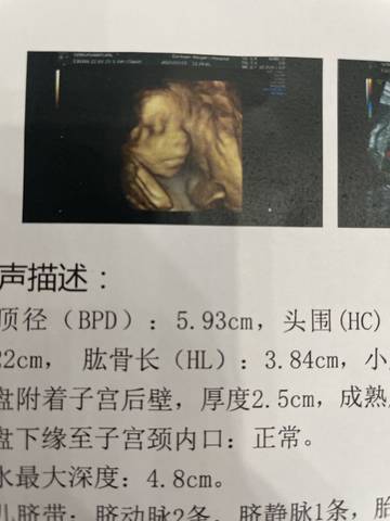 journal_insert_pic_1741050170