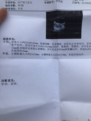 journal_insert_pic_1689652898