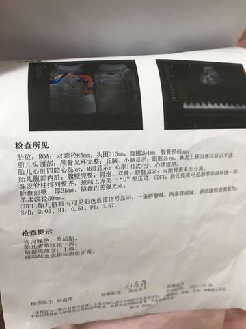 journal_insert_pic_1684949942