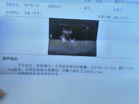 journal_insert_pic_1687789002