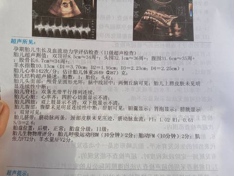 journal_insert_pic_1683556190