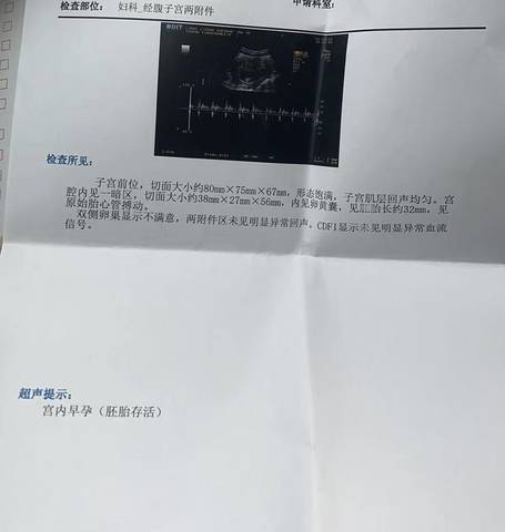 journal_insert_pic_1740927735
