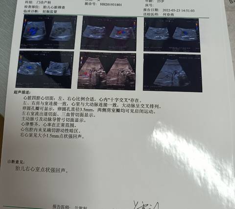 journal_insert_pic_1740986649